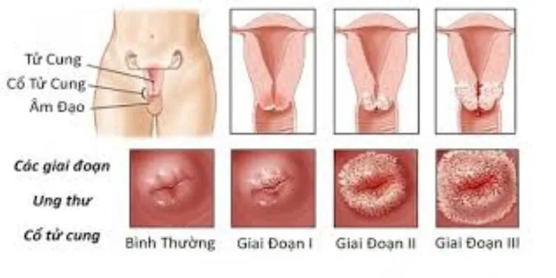 tại sao phải